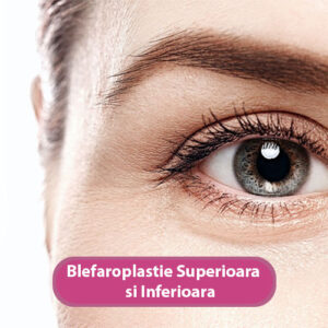 blefaroplastie superioara+ inferioara