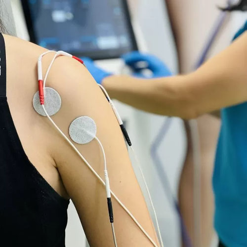 electrostimulare