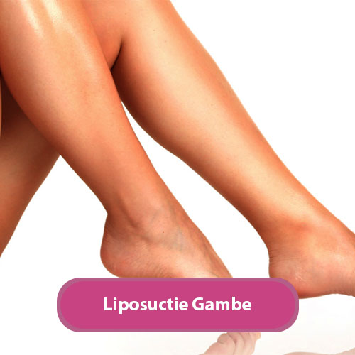 liposuctie gambe