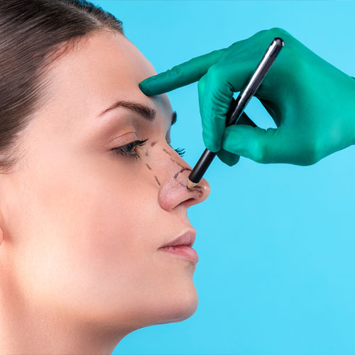 rinoplastie inchisa